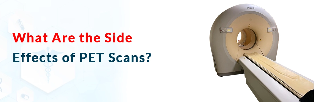  What Are the Side Effects of PET Scans?